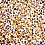 HSP84 Antibody in Immunocytochemistry (ICC/IF)