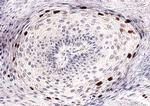 HPV 16 Antibody in Immunohistochemistry (PFA fixed) (IHC (PFA))