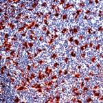 CD68/Macrophage Antibody in Immunohistochemistry (Paraffin) (IHC (P))