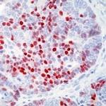 p57 /Kip2 Antibody in Immunohistochemistry (Paraffin) (IHC (P))