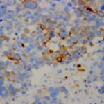 Chromogranin A Antibody in Immunohistochemistry (Paraffin) (IHC (P))