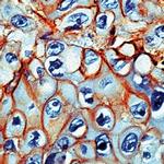 EGFR 1 Antibody in Immunohistochemistry (Paraffin) (IHC (P))