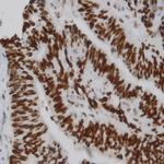 p53 Antibody in Immunohistochemistry (Paraffin) (IHC (P))