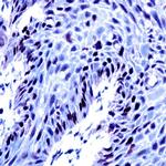 Retinoblastoma (RB) Antibody in Immunohistochemistry (Paraffin) (IHC (P))