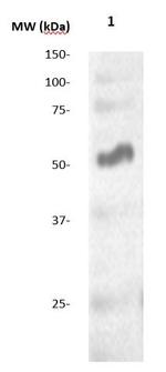 Alkaline Phosphatase (AP) Antibody in Western Blot (WB)