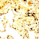 Raf -A Antibody in Immunohistochemistry (Paraffin) (IHC (P))