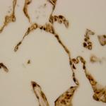 BCL-10 Antibody in Immunohistochemistry (Paraffin) (IHC (P))
