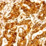 CDC34 Antibody in Immunohistochemistry (Paraffin) (IHC (P))