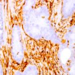 CDC37 Antibody in Immunohistochemistry (Paraffin) (IHC (P))