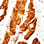 Cdk8 Antibody in Immunohistochemistry (Paraffin) (IHC (P))
