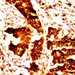 c-erbB-3/HER-3 Antibody in Immunohistochemistry (Paraffin) (IHC (P))
