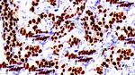 Cyclin C Antibody in Immunohistochemistry (Paraffin) (IHC (P))