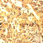Glycogen Synthase Kinase 3b (GSK3b) Antibody in Immunohistochemistry (Paraffin) (IHC (P))