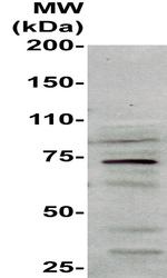 Heat Shock Factor 1 Antibody in Western Blot (WB)