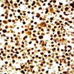 I-Kappa-B Kinase b (IKKb) Antibody in Immunocytochemistry (ICC/IF)