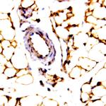 JNK Activating kinase (JKK1) Antibody in Immunohistochemistry (Paraffin) (IHC (P))