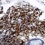 MHC I (HLA-A,B,C) Antibody in Immunohistochemistry (Paraffin) (IHC (P))
