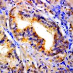 p73 Antibody in Immunohistochemistry (Paraffin) (IHC (P))