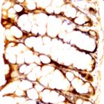 Raf-1 Antibody in Immunohistochemistry (Paraffin) (IHC (P))
