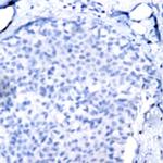 IL-6 Antibody in Immunohistochemistry (Paraffin) (IHC (P))