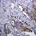 Phospho-IRS-1 (Ser312) Antibody in Immunohistochemistry (Paraffin) (IHC (P))