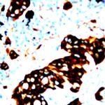 Phospho-IRS-1 (Ser312) Antibody in Immunohistochemistry (Paraffin) (IHC (P))
