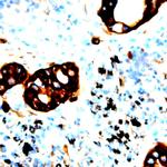 Phospho-IRS-2 (Ser731) Antibody in Immunohistochemistry (Paraffin) (IHC (P))