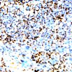 PKC Antibody in Immunohistochemistry (Paraffin) (IHC (P))