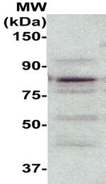 PKC Antibody in Western Blot (WB)