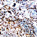 Phospho-PKC (Ser345) Antibody in Immunohistochemistry (Paraffin) (IHC (P))