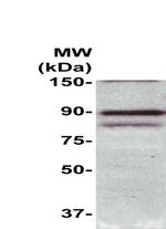 Phospho-PKC (Ser345) Antibody in Western Blot (WB)