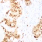 STAT1 Antibody in Immunohistochemistry (Paraffin) (IHC (P))