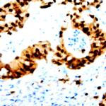 Phospho-STAT5 (Tyr694) Antibody in Immunohistochemistry (Paraffin) (IHC (P))