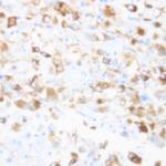 CCR5 Antibody in Immunohistochemistry (Paraffin) (IHC (P))