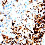 CCR8 Antibody in Immunohistochemistry (Paraffin) (IHC (P))