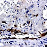 IRAK-2 Antibody in Immunohistochemistry (Paraffin) (IHC (P))
