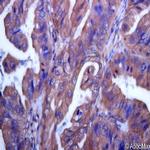 IRAK-M Antibody in Immunohistochemistry (Paraffin) (IHC (P))
