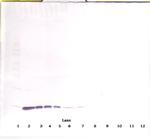 IL-2 Antibody in Western Blot (WB)