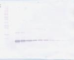 TNFR2 (soluble) Antibody in Western Blot (WB)