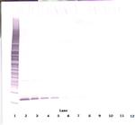 APRIL Antibody in Western Blot (WB)