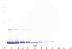 GM-CSF Polyclonal Antibody, PeproTech®