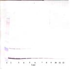 MIA Antibody in Western Blot (WB)
