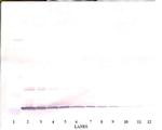 Artemin Antibody in Western Blot (WB)
