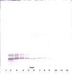 DEFB104A Antibody in Western Blot (WB)
