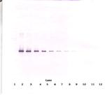 Neuroserpin Antibody in Western Blot (WB)