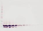 TFF2 Antibody in Western Blot (WB)