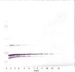 TNF beta Polyclonal Antibody, PeproTech®