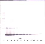 GM-CSF Polyclonal Antibody, Biotin, PeproTech®