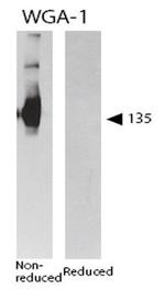 Platelet GMP-140 (P-selectin/CD62) Antibody in Immunohistochemistry (Frozen) (IHC (F))