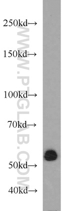 GFP tag Antibody in Western Blot (WB)